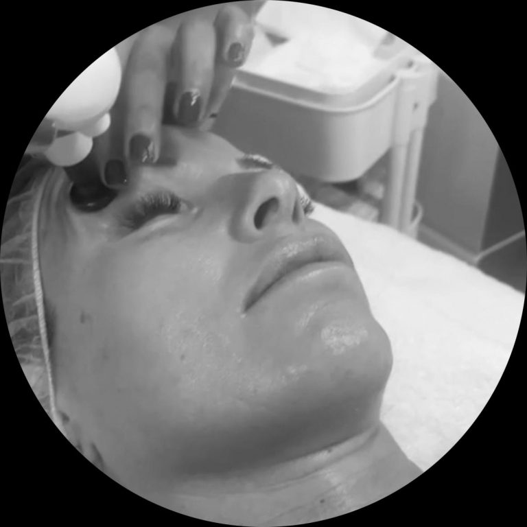 Mejora la firmeza y luminosidad de tu piel con nuestro tratamiento de radiofrecuencia facial en Madrid. Resultados visibles y seguros.